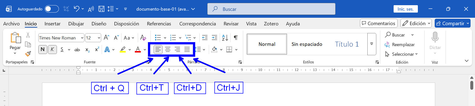 Botones de alineación